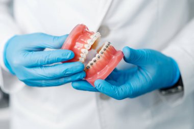 Closeup of doctor male hands in gloves holding prosthetic human jaws with metal braces. Visit to dentist, orthodontist concept.