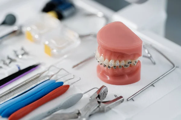 Μοντέλο Δοντιών Μεταλλικά Στηρίγματα Ξαπλωμένα Ένα Οδοντιατρικό Τραπέζι Όργανα Έννοια — Φωτογραφία Αρχείου
