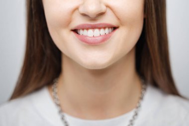 Happy caucasian female smile with white teeth isolated on white background