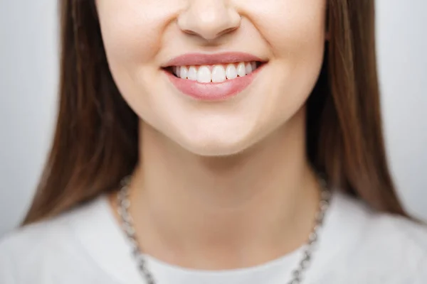 Happy Caucasian Female Smile White Teeth Isolated White Background — Stock Fotó