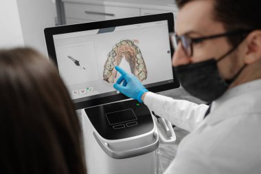 Male doctor show results of digital intraoral scan of patient teeth in 3D on display. Dentist point finger on screen