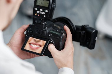 Dentist holding photo camera with picture of healthy smile on a screen. Special camera with flash ring shadowless.