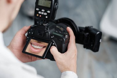 Dentist holding photo camera with picture of healthy smile on a screen. Special camera with flash ring shadowless.