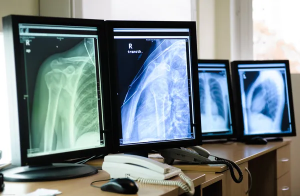 Röntgenaufnahmen menschlicher Körperteile — Stockfoto
