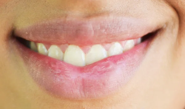 Extreme closeup of woman mouth smiling — Stock Photo, Image