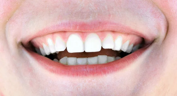 Dientes de mujer sanos —  Fotos de Stock