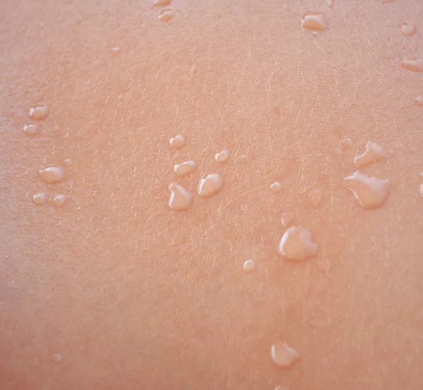 Gotas de água no tiro macro da pele humana — Fotografia de Stock