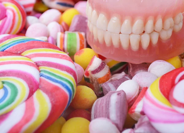 Candy and denture - Conceito de problema de cavidade — Fotografia de Stock