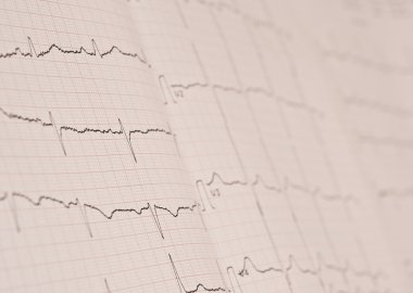 Detail of an electrocardiogram in paper