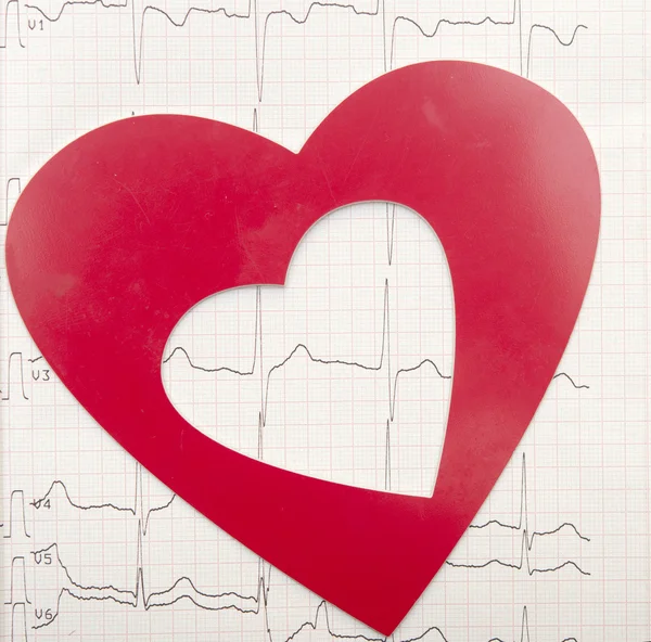 Coração e eletrocardiograma — Fotografia de Stock