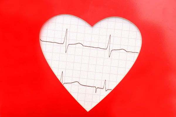 Heart cardiogram with heart on it — Stock Photo, Image