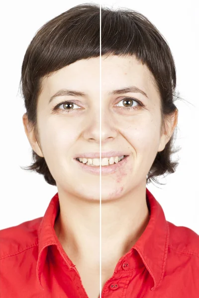Guérison de la peau avant et après — Photo