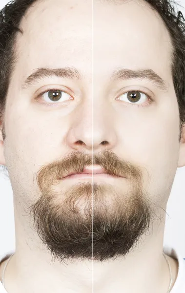 Before after faces — Stock Photo, Image