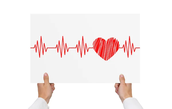 Papel con cardiograma — Foto de Stock