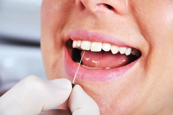 Dentista esamina i denti — Foto Stock