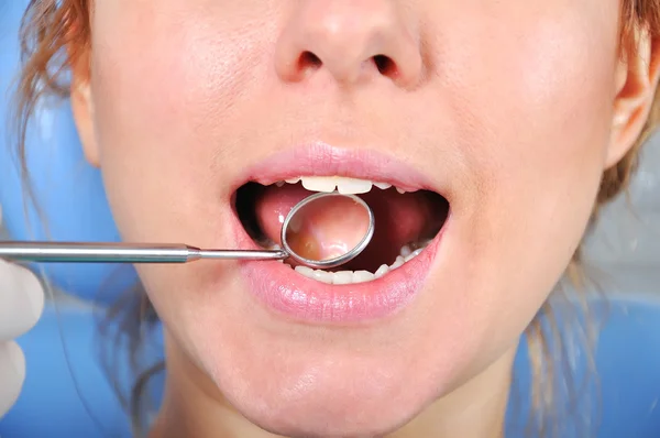 歯の検査 — ストック写真