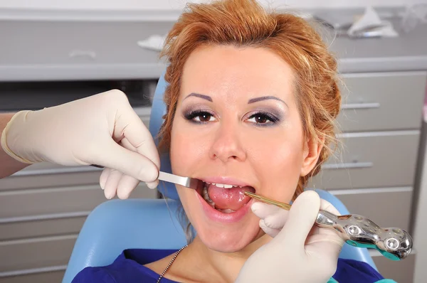 Hiermee verwijdert u tand — Stockfoto