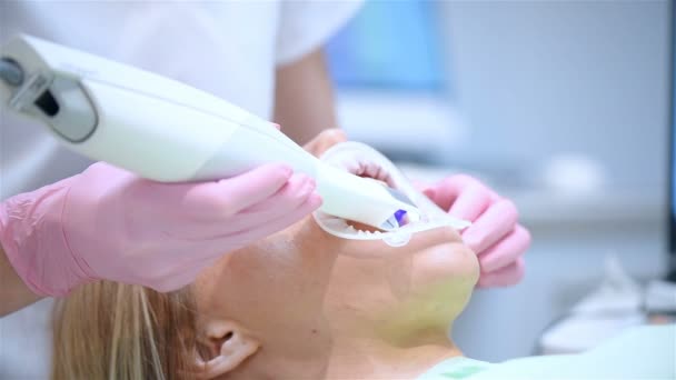 Diş Tarayıcı Ile Pembe Eldivenli Ortodontist Hastayı Tarıyor Prostodontik Stomatoloji — Stok video