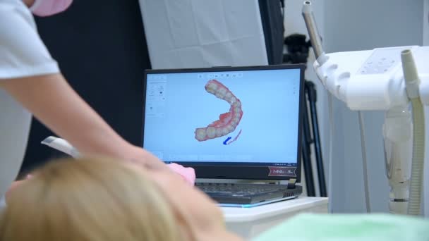 Zahnarzt Zeigt Patient Gescanntes Modell Seines Kiefers Auf Laptop Bildschirm — Stockvideo