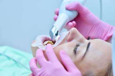 Pembe eldivenli dişçi, diş kliniğinde 3 boyutlu tarama makinesiyle dişleri tarıyor. Modern dişçilik ve sağlık hizmetleri konsepti. Kapat.