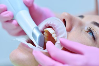 Diş taraması için 3D intraoral tarayıcı kullanan bir ortodontist. Ekipmanlı modern diş kliniği. Diş ve sağlık hizmetleri konsepti. Kapat.