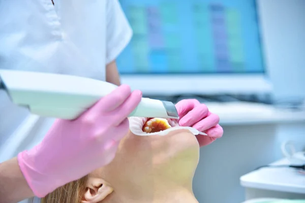 Orthodontiste Numérisation Des Dents Avec Machine Numérisation Dans Clinique Dentaire — Photo