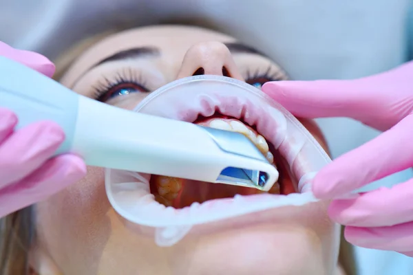 Orthodontiste Scaning Patient Avec Scanner Dentaire Intraoral Clinique Dentaire Moderne — Photo