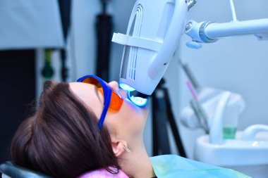 Diş sağlığı kliniğinde hasta için diş beyazlatma. Diş hekimliğinde diş beyazlatma. Diş ve diş beyazlatma konsepti. Kapat.