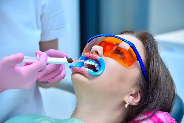 Woman Dentist Applies Whitening Gel Patient Teeth Teeth Whitening Dental — Stock Photo, Image