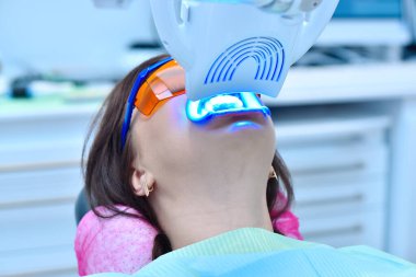 Klinikteki lazer beyazlatıcı dişleri kapatın. Hasta için diş beyazlatma. Diş hekiminde diş beyazlatma..