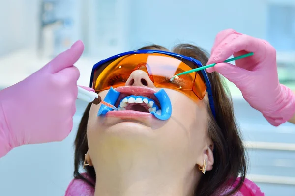 Dentista Assistente Aplica Gel Clareador Aos Dentes Paciente Clínica Odontológica — Fotografia de Stock