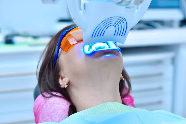 Detailní Záběr Bělících Zubů Klinice Bělení Zubů Pro Pacienta Bělení — Stock fotografie