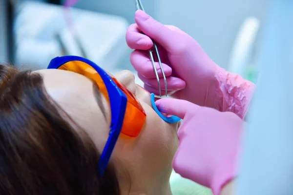 Närbild Kvinna Patient Med Skyddsglasögon Och Upprullningsdon För Tandblekning Förfarande — Stockfoto