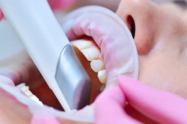 Gros Plan Dentiste Effectuant Une Numérisation Dentaire Des Dents Des — Photo