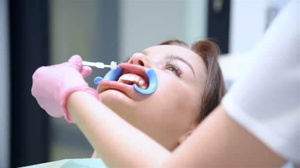 Dentista Selecciona Sombra Los Dientes Del Paciente Tratamiento Dental Higiene — Vídeos de Stock