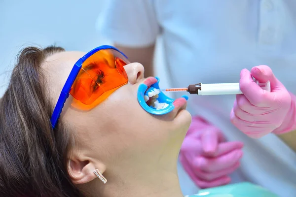 在牙科诊所 戴着粉红手套的牙医在病人的牙齿上涂美白凝胶 牙齿美白在牙科诊所的概念 靠近点 — 图库照片