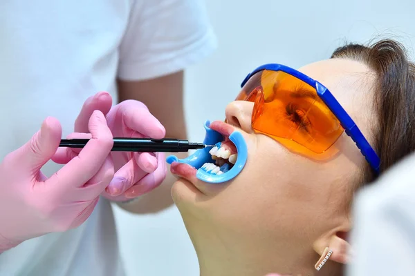 Dentista Aplica Gel Blanqueador Los Dientes Del Paciente Clínica Dental — Foto de Stock