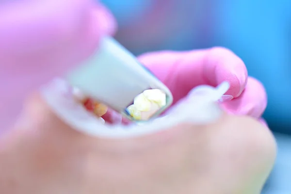 Gros Plan Dentiste Effectuant Une Numérisation Des Dents Des Patients — Photo