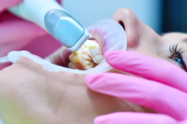 Primer Plano Del Dentista Guantes Rosados Haciendo Escaneo Los Dientes —  Fotos de Stock