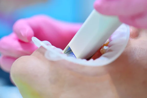 Kvinna Tandläkare Rosa Handskar Med Hjälp Dental Intraoral Scanner Samtidigt — Stockfoto