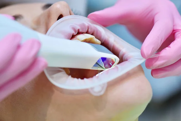 Close Mãos Dentista Luvas Rosa Digitalizando Dentes Paciente Com Scanner — Fotografia de Stock