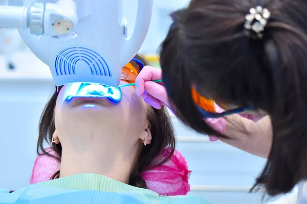 Laserblekande Tänder Tandkliniken Tandblekning För Patienten Skyddsglasögon Tandblekning Tandläkarkliniken Närbild — Stockfoto