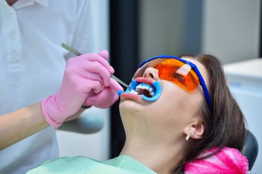Doctor hands with tweezers inserts a cotton swab into her mouth. Beautiful girl in safety glasses and retractor. Dental and teeth whitening concept.