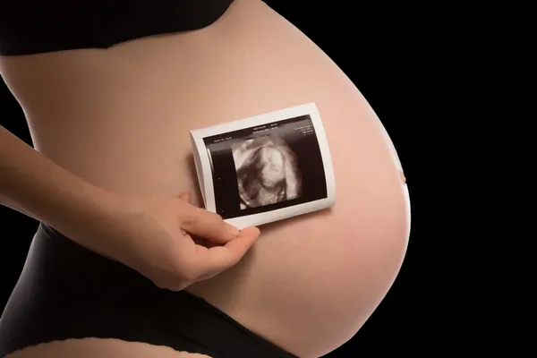 Pregnant Woman — Stock Photo, Image