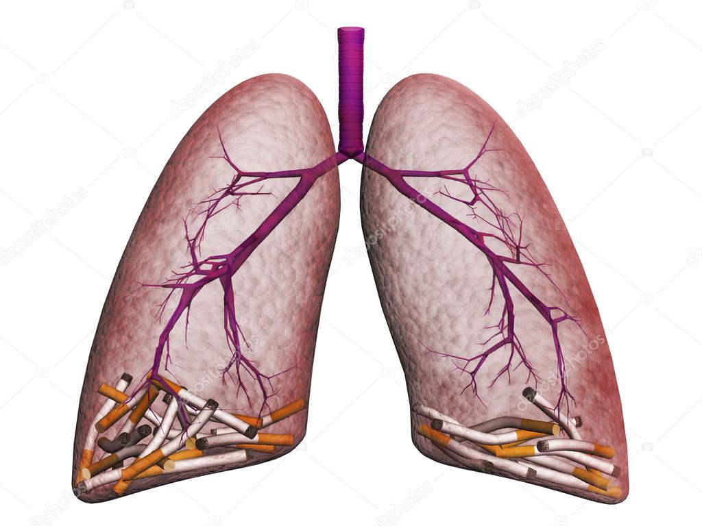 Smokers lungs on a white background — Stock Photo © sssccc 16647871