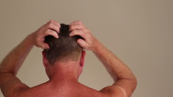 Both Hands Shirtless Adult White Caucasian Man Massaging His Scalp – Stock-video