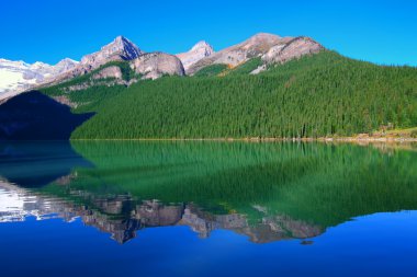 Lake louise banff Ulusal Parkı