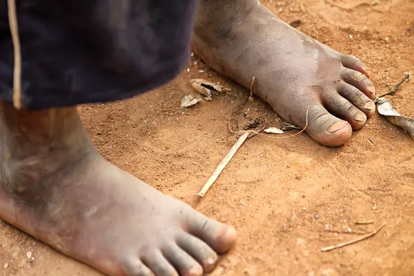 Los pies del niño africano — Foto de Stock