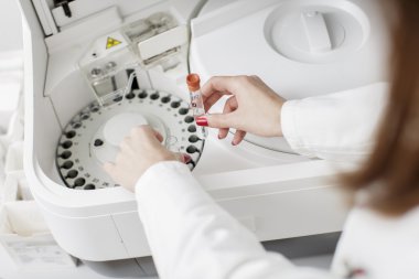 modern Tıp laboratuarında santrifüj kapasitesi