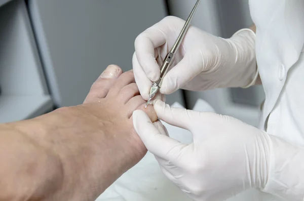 Tratamiento de pedicura —  Fotos de Stock